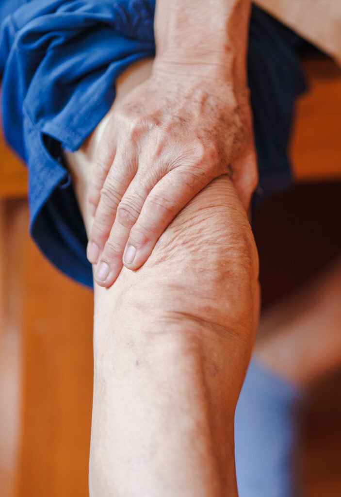 Foto de una rodilla con artrosis